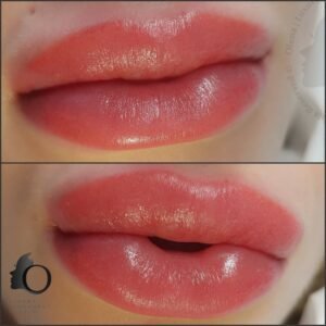 Permanent Lip Tattoo