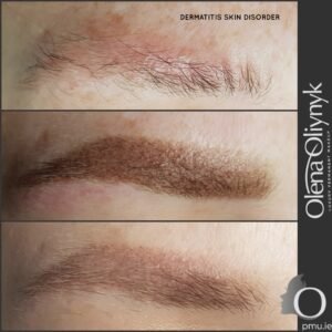 Powder Semi Permanent Makeup Brows skin disorder