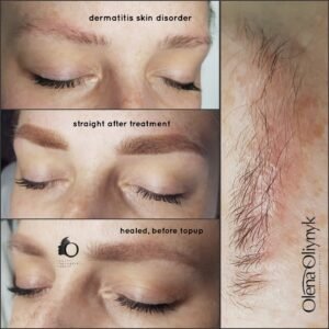 Powder Semi Permanent Makeup Brows skin disorder